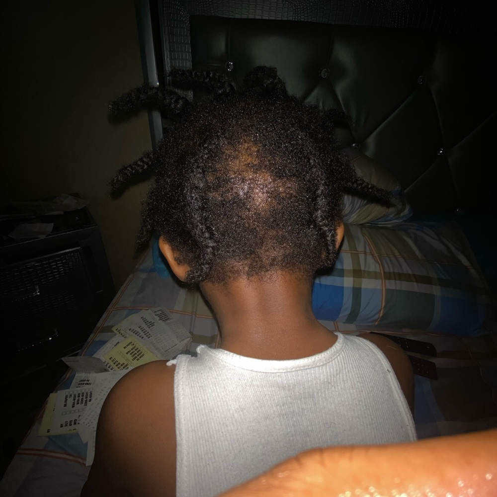 Hair growth oils